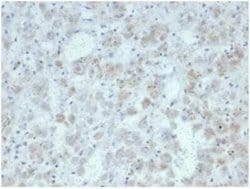 IL-15 Rabbit anti-Human, Clone: IL15/7048R, Novus Biologicals 20 &mu;g | Buy Online | Novus Biologicals | Fisher Scientific